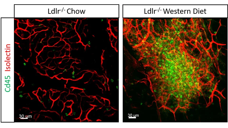 Diet Induced Vascular Inflammation