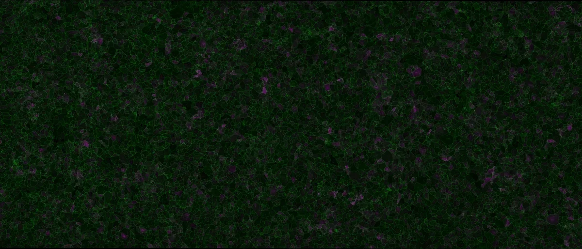 Endothelial cells imaged for cell junctions (in green) and an inflammatory marker (in purple).