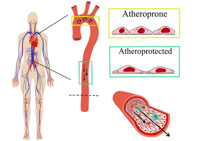 Illustration of the aorta, a candy-cane shaped blood vessel.