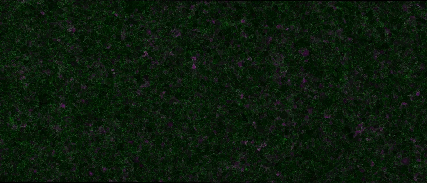 Endothelial cells imaged for cell junctions (in green) and an inflammatory marker (in purple).