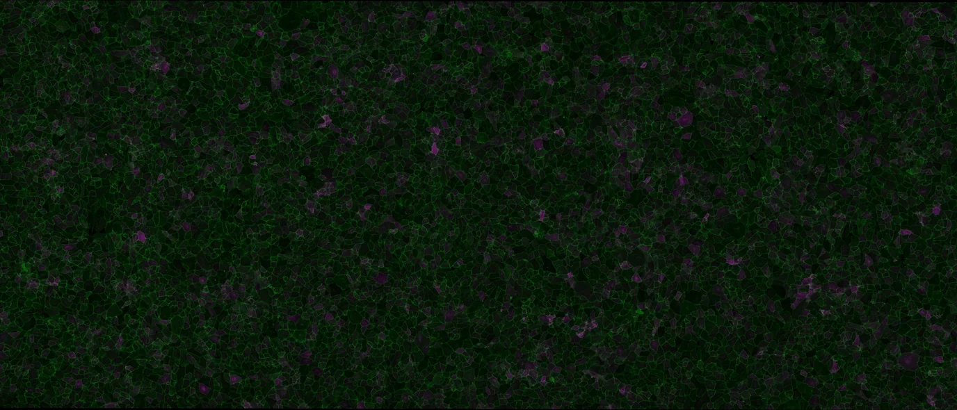 Endothelial cells imaged for cell junctions (in green) and an inflammatory marker (in purple).